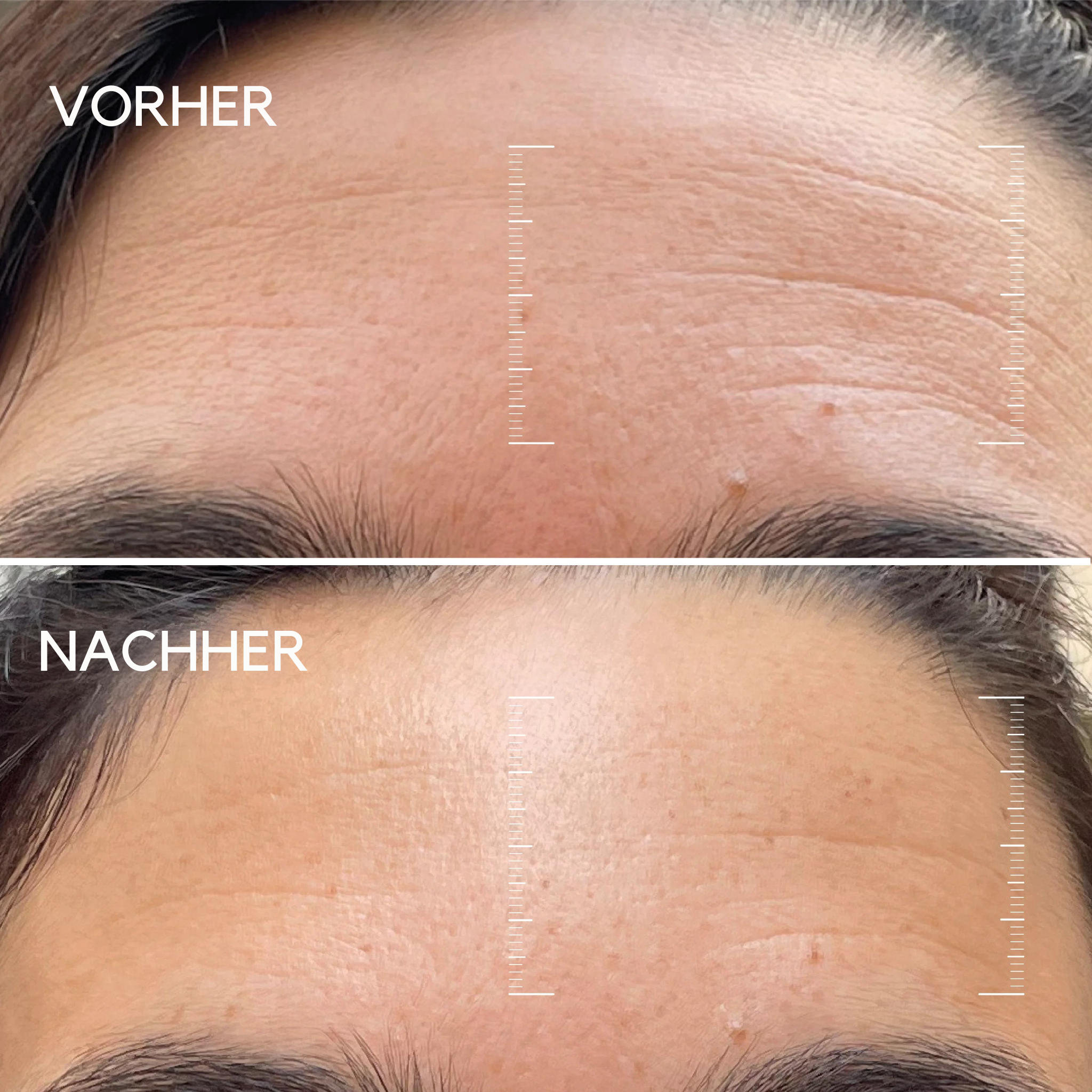 Koreanische Bio Kollagen Maske